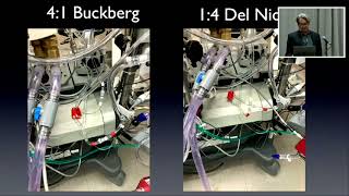 Isolated Cerebral Perfusion during Extra Anatomic Innominate and Left Carotid Artery Revascularizati [upl. by Else]