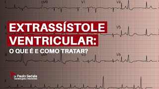 Extrassístole Ventricular o que é e como tratar [upl. by Lleret517]