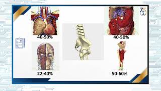 Paciente politraumatizado con fractura de pelvis ¿control de daño [upl. by Batchelor636]