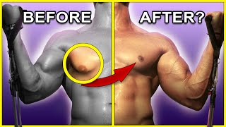 How I reduced GYNO Manboobs with EXERCISE [upl. by Dhiman]