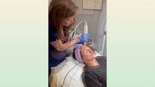 Skin Rejuvenation  Microneedling [upl. by Paulsen365]