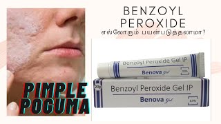 benzoyl peroxide gel review in tamil  why it is used [upl. by Hereld251]