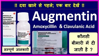 Augmentin Amoxicillin amp Clavulanic Acid UsesSide EffectPrecautionsDose क्या बच्चों के लिए है [upl. by Xer]