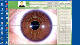 Iriscope iris analyzer iridology [upl. by Lletnom]