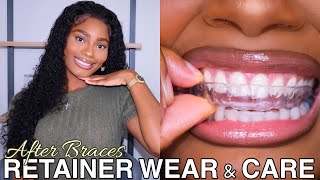 Life After Adult Braces  Retainer Wear amp Care  Confidence Boost  Teeth Whitening  Oral Hygiene [upl. by Honan]