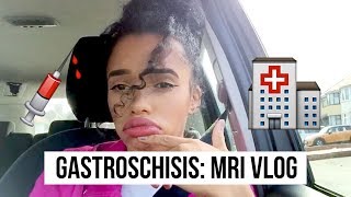 GASTROSCHISIS SMALL BOWEL MRI VLOG [upl. by Ynettirb]