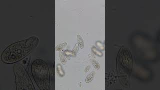 Paramecium population in one week old river water science microscope 17 [upl. by Linnie]