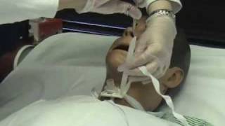 Trach Care Part 2mov [upl. by Notlil934]