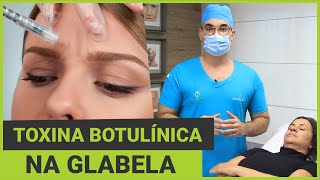 Botox®  Toxina Botulínica na Glabela [upl. by Moulton]