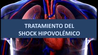 Shock hipovolémico  Tratamiento [upl. by Hourigan]