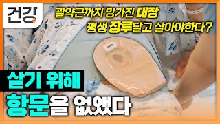 살기 위해 항문 포기했다  직장암 살기 위해 항문 없애고 평생 장루달고 살아야 한다  명의  EBS건강 [upl. by Cheston554]