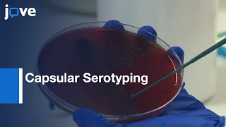 Capsular Serotyping Streptococcus pneumoniae Using Quellung Reaction [upl. by Wilcox]