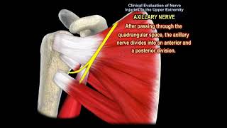 NERVE INJURY IN THE UPPER EXTREMITY Everything You Need To Know  Dr Nabil Ebraheim [upl. by Merrilee]