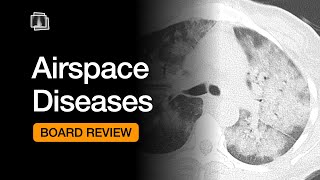 Airspace Diseases  Chest Radiology Board Review [upl. by Ayikin]