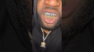 2 TONE SET grillz customgrillz baguettes goldgrillz whitegold vvs blingbling [upl. by Etezzil]