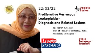 Oral Pathology Proliferative verrucous Leukoplakia – Issues in Diagnosis and its Related Lesions [upl. by Twedy]