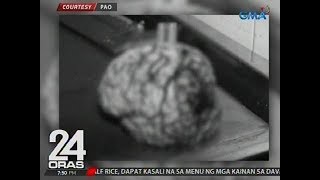 24 Oras Batang nabigyan ng Dengvaxia tumatagas ang dugo sa utak ayon sa PAO [upl. by Etnahc]