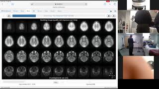 DEMO Hyperfine Bedside MRI [upl. by Ah]