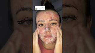 ACNE TIPS THAT WORK😱 follow for more💗 acne acnetreatment skincare skincareroutine skin [upl. by Nnylyoj]