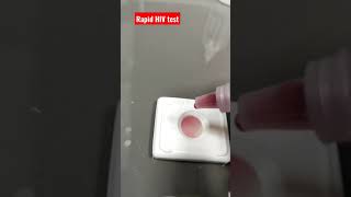 HIV Rapid Test Negative lab technician sample reagents viralshorts [upl. by Bradford]