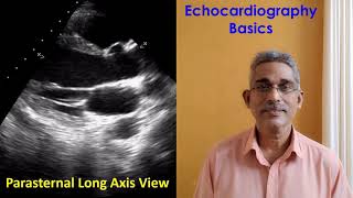 Echocardiography Basics [upl. by Oileduab]