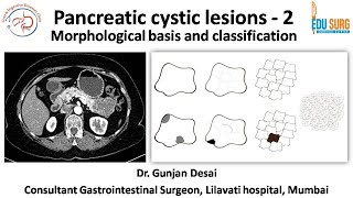 Pancreatic cystic lesions  morphology based classification of pancreatic cysts  Part 2 [upl. by Dnalro623]