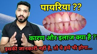 पायरिया क्या है  इसके कारण लक्षण और इलाज । pyriya  periodontitis causes symptoms amp treatment [upl. by Suirtemed666]