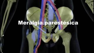 Meralgia Parestésica [upl. by Abrahamsen317]