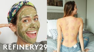 5 Days Of Natural Remedies  Try Living With Lucie  Refinery29 [upl. by Azmuh]