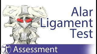 Alar Ligament Stress Test  Upper Cervical Spine Instability [upl. by Mallory]