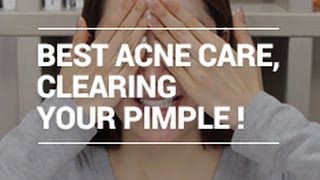 The Best ACNE Care Tips for Clearing Pimple with Eunices naked face XD  Wishtrend [upl. by Noiemad]