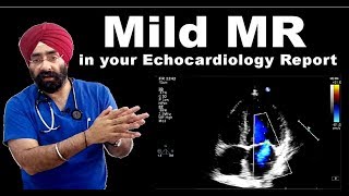 Rx Heart 20 Hindi क्या होता है Mild MR mitral regurgitation Dil me Valve Leak  DrEducation [upl. by Kcirdor]