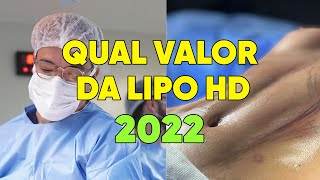 QUAL VALOR DA LIPO HD 2022 [upl. by Coussoule]