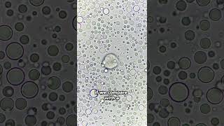 Raw Cows Milk VS Human Breast Milk under the microscope [upl. by Sadiras562]