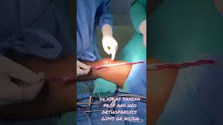 Central quadriceps tendon graft harvest [upl. by Aneda]