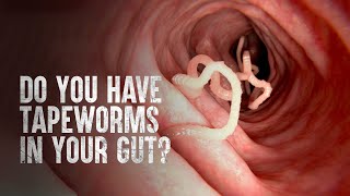 How to Survive Tapeworms Warning distressing footage [upl. by Anirt]