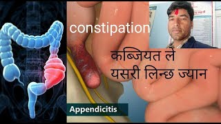 Appendicitis Causesigns symptoms and treatment [upl. by Bikales444]