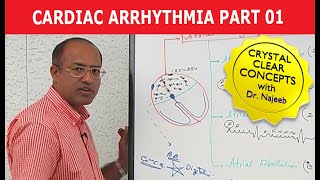 Cardiac Arrhythmia  Part 13 [upl. by Aikemal]