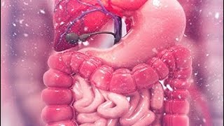 Diverticulum part 1 [upl. by Lanfri]