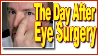 Surviving Eye Surgery  The Day After Chalazion Part 2 [upl. by Attikin]