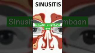 How to get rid of sinusitis sinusitis allergicrhinitis allergy ytshorts health pranyam yoga [upl. by Margy]