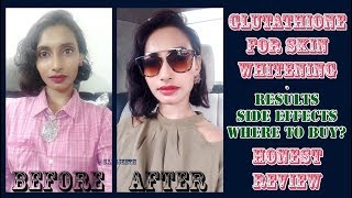 Glutathione Skin Whitening Tablets Results  Genuine Customer Review  SahiJeeth [upl. by Ayiram93]