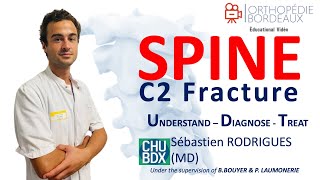 Fractures de la vertèbre cervicale C2 par le Dr Rodrigues [upl. by Nhoj676]