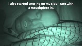 VitalSleep Stop Snoring Mouthpiece Review Live Results [upl. by Attem792]