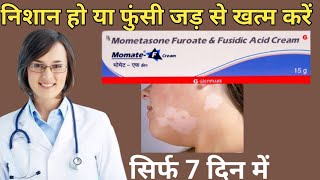 momate f cream use in hindi mometasonefusidic acid [upl. by Animehliw]