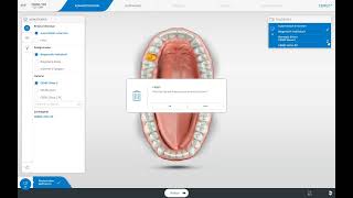 CEREC Software 5 Die Administrationsphase [upl. by Anneliese28]