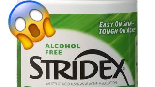 Stridex Acne Pads 😩 Must Watch  👀 [upl. by Wyne]