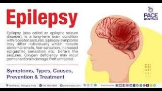 What really causes epilepsy  Symptoms of Epilepsy  Mirgi kya hota h  Mirgi kyu hota h  Hindi [upl. by Jehiel]