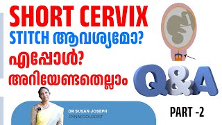 Short cervix  എപ്പോഴും stitch ആവശ്യമുണ്ടോ PART 2  DRSUSAN JOSEPH [upl. by Peck]