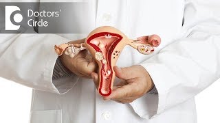 What is Diagnostic Laparoscopy  Dr Nupur Sood [upl. by Koh]